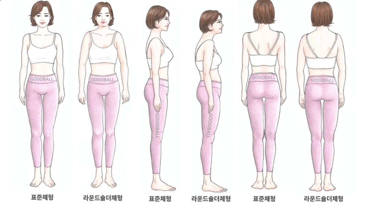 라운드숄더로 인한 체형 변형 앞&뒤&옆